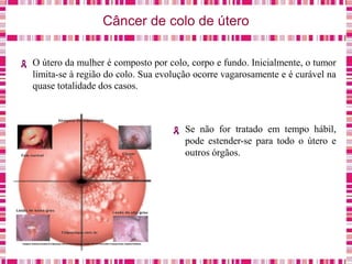 Câncer de colo de útero
O útero da mulher é composto por colo, corpo e fundo. Inicialmente, o tumor
limita-se à região do colo. Sua evolução ocorre vagarosamente e é curável na
quase totalidade dos casos.
Se não for tratado em tempo hábil,
pode estender-se para todo o útero e
outros órgãos.
 