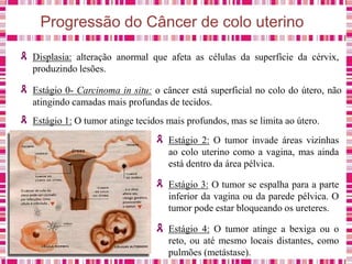 Progressão do Câncer de colo uterino
Displasia: alteração anormal que afeta as células da superfície da cérvix,
produzindo lesões.
Estágio 0- Carcinoma in situ: o câncer está superficial no colo do útero, não
atingindo camadas mais profundas de tecidos.
Estágio 1: O tumor atinge tecidos mais profundos, mas se limita ao útero.
Estágio 2: O tumor invade áreas vizinhas
ao colo uterino como a vagina, mas ainda
está dentro da área pélvica.
Estágio 3: O tumor se espalha para a parte
inferior da vagina ou da parede pélvica. O
tumor pode estar bloqueando os ureteres.
Estágio 4: O tumor atinge a bexiga ou o
reto, ou até mesmo locais distantes, como
pulmões (metástase).
 