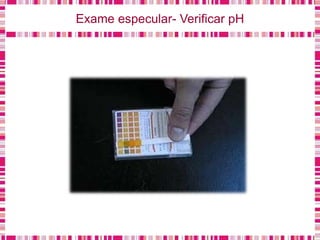 Exame especular- Verificar pH
 