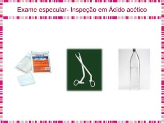 Exame especular- Inspeção em Ácido acético
 