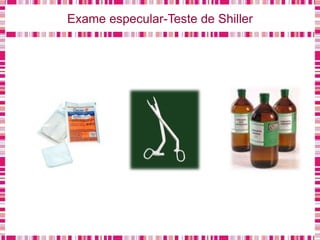 Exame especular-Teste de Shiller
 