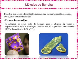 Métodos de Barreira
Impedem que ocorra a fecundação, evitando que o espermatozoide encontre o
óvulo, criando barreiras físicas.
• Preservativo masculino:
É colocada no pênis ereto do homem, com o objetivo de barrar o
espermatozoide após a ejaculação. Previne não só a gravidez, mas também
DST’s. Tem eficácia de 90 a 97%.
 
