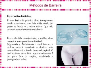 Métodos de Barreira
• Preservativo feminino:
É uma bolsa de plástico fino, transparente,
macio e resistente, com dois anéis, sendo um
preso na borda e o outro móvel (que não
deve ser removido) dentro da bolsa.
Para colocá-la corretamente, a mulher deve
encontrar uma posição confortável.
Segurando e flexionando o anel interno, a
mulher deverá introduzir e deslizar esta
extremidade até o fundo do canal vaginal. O
anel externo deve ficar aproximadamente 3
cm para fora da vagina, recobrindo e
protegendo a vulva.
 