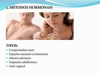 2. MÉTODOS HORMONAIS
TIPOS:
 Comprimidos orais
 Injeções mensais e trimestrais
 Adesivo dérmico
 Implante subdérmico
 Anel vaginal
 