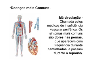 •Doenças mais Comuns

                          Má circulação -
                           Chamada pelos
                  médicos de insuficiência
                   vascular periférica. Os
                   sintomas mais comuns
                  são dores nas pernas,
                       que aparecem com
                       freqüência durante
                  caminhadas, e passam
                      durante o repouso.
 