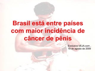 Brasil está entre países com maior incidência de câncer de pênis Exclusivo VEJA.com ,  19 de agosto de 2009 