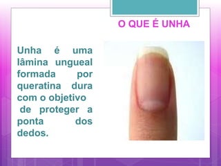 O QUE É UNHA
Unha é uma
lâmina ungueal
formada por
queratina dura
com o objetivo
de proteger a
ponta dos
dedos.
 