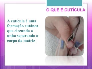 O QUE É CUTÍCULA
A cutícula é uma
formação cutânea
que circunda a
unha separando o
corpo da matriz
 