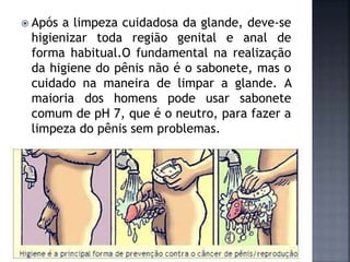  Após a limpeza cuidadosa da glande, deve-se
higienizar toda região genital e anal de
forma habitual.O fundamental na realização
da higiene do pênis não é o sabonete, mas o
cuidado na maneira de limpar a glande. A
maioria dos homens pode usar sabonete
comum de pH 7, que é o neutro, para fazer a
limpeza do pênis sem problemas.
 