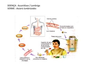 DOENÇA: Ascaridíase / Lombriga
VERME : Ascaris lumbricoides
 
