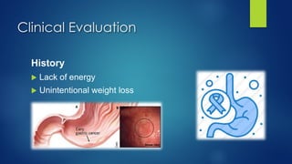 Clinical Evaluation
History
u Lack of energy
u Unintentional weight loss
 