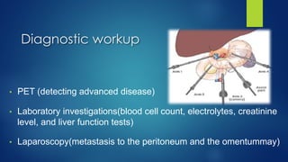 • PET (detecting advanced disease)
• Laboratory investigations(blood cell count, electrolytes, creatinine
level, and liver function tests)
• Laparoscopy(metastasis to the peritoneum and the omentummay)
Diagnostic workup
 