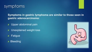 symptoms
Symptoms in gastric lymphoma are similar to those seen in
gastric adenocarcinoma:
✘ Upper abdominal pain
✘ Unexplained weight loss
✘ Fatigue
✘ Bleeding
 