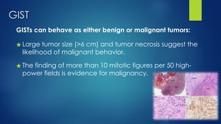 GIST
GISTs can behave as either benign or malignant tumors:
★ Large tumor size (>6 cm) and tumor necrosis suggest the
likelihood of malignant behavior.
★ The finding of more than 10 mitotic figures per 50 high-
power fields is evidence for malignancy.
 