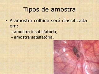 Tipos de amostra
• A amostra colhida será classificada
em:
– amostra insatisfatória;
– amostra satisfatória.
 