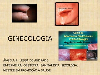 GINECOLOGIA
ÂNGELA R. LESSA DE ANDRADE
ENFERMEIRA, OBSTETRA, SANITARISTA, SEXÓLOGA;
MESTRE EM PROMOÇÃO À SAÚDE
Ângela Lessa de Andrade
EMAIL: angelalessadeandrade@yahoo.com.br /
GOOGLE 2014
 