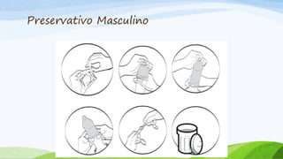 Preservativo Masculino
 