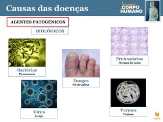 Causas das doenças
AGENTES PATOGÉNICOS
BIOLÓGICOS
Bactérias
Pneumonia
Fungos
Pé-de-atleta
Protozoários
Doença do sono
Vírus
Gripe
Vermes
Teníase
 