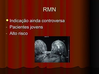 RMN
 Indicação ainda controversa
- Pacientes jovens
- Alto risco
 