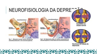 NEUROFISIOLOGIA DA DEPRESSÃO
 