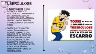 TUBERCULOSE
• A TUBERCULOSE É UMA
DOENÇA ALTAMENTE
CONTAGIOSA, CAUSADA POR
UM MICROORGANISMO
CHAMADO MYCOBACTERIUM
TUBERCULOSIS, TAMBÉM
CONHECIDO POR BACILO DE
KOCH.
• TOSSE CONTÍNUA COM
DURAÇÃO DE MAIS DE
QUATRO SEMANAS, COM
PRODUÇÃO DE ESCARRO,
PODENDO APRESENTAR
SANGUE, FEBRE, SUOR
EXCESSIVO À NOITE, FALTA
DE APETITE, PERDA DE PESO
E FRAQUEZA SÃO OS
PRINCIPAIS SINTOMAS DA
TUBERCULOSE.
José Marcos
 
