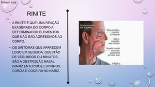 RINITE
• A RINITE É QUE UMA REAÇÃO
EXAGERADA DO CORPO A
DETERMINADOS ELEMENTOS
QUE NÃO SÃO AGRESSIVOS AO
CORPO.
• OS SINTOMAS QUE APARECEM
LOGO EM SEGUIDA, QUESTÃO
DE SEGUNDOS OU MINUTOS,
SÃO A OBSTRUÇÃO NASAL
(NARIZ ENTUPIDO), ESPIRROS,
CORIZA E COCEIRA NO NARIZ.
Míriam Laís
 