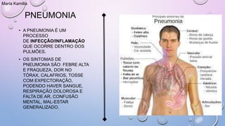 PNEUMONIA
• A PNEUMONIA É UM
PROCESSO
DE INFECÇÃO/INFLAMAÇÃO
QUE OCORRE DENTRO DOS
PULMÕES.
• OS SINTOMAS DE
PNEUMONIA SÃO: FEBRE ALTA
E FRAQUEZA, DOR NO
TÓRAX, CALAFRIOS, TOSSE
COM EXPECTORAÇÃO,
PODENDO HAVER SANGUE,
RESPIRAÇÃO DOLOROSA E
FALTA DE AR, CONFUSÃO
MENTAL, MAL-ESTAR
GENERALIZADO.
Maria Kamilla
 