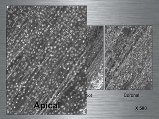 Apical Mid-Root Coronal D75 X 500 Apical 