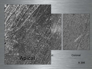 Apical Mid-Root Coronal D75 X 200 Apical 