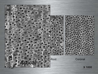 Apical Mid-Root Coronal F48 X 1000 Apical 