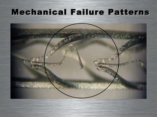 Mechanical Failure Patterns 
