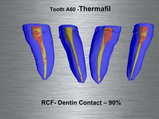 RCF- Dentin Contact – 90% Tooth A60 -  Thermafil 