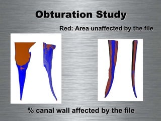 Obturation Study % canal wall affected by the file Red: Area unaffected by the file 