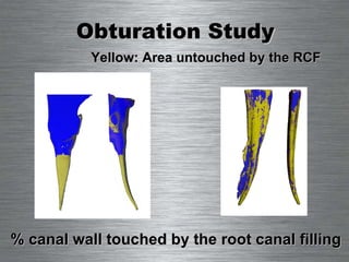 Obturation Study % canal wall touched by the root canal filling Yellow: Area untouched by the RCF 
