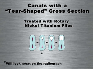 Treated with Rotary  Nickel Titanium Files Canals with a  “ Tear-Shaped” Cross Section * * Will look great on the radiograph 