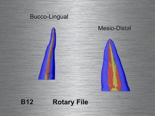 Bucco-Lingual B12  Rotary File Mesio-Distal 