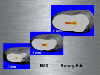 2 mm B53  Rotary File 2 mm 4 mm 6 mm 