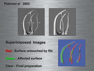 Peters  et al   2003 Superimposed  Images Red  : Surface untouched by file Green  : Affected surface Clear : Final preparation 