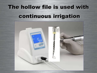 The hollow file is used with  continuous irrigation 