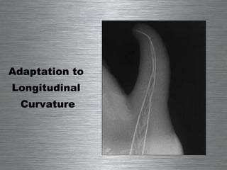 Adaptation to  Longitudinal  Curvature 