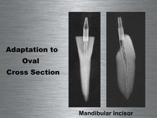 Mandibular Incisor Adaptation to  Oval  Cross Section 