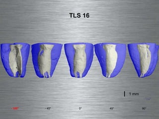 0° - 45° -   180° 90° 45° TLS 16 1 mm 