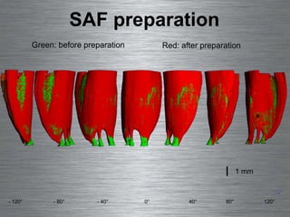 SAF preparation 0° - 40° - 120° - 80° 120° 80° 40° Green: before preparation Red: after preparation 1 mm 