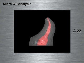 Micro CT Analysis A 22 