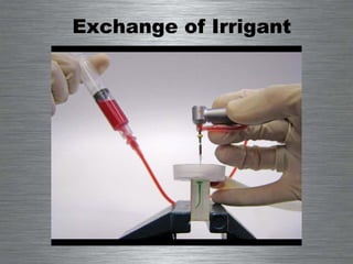 Exchange of Irrigant 