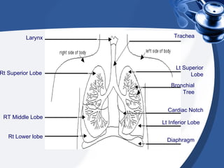 Larynx Rt Superior Lobe RT Middle Lobe Rt Lower lobe Lt Superior Lobe Bronchial Tree Cardiac Notch Trachea Lt Inferior Lobe Diaphragm 