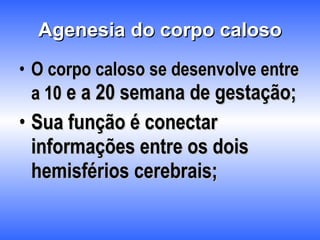 Agenesia do corpo caloso O corpo caloso se desenvolve entre a 10  e a 20 semana de gestação; Sua função é conectar informações entre os dois hemisférios cerebrais; 
