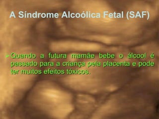 A Síndrome Alcoólica Fetal (SAF) Quando a futura mamãe bebe o álcool é passado para a criança pela placenta e pode ter muitos efeitos tóxicos.  