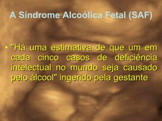 A Síndrome Alcoólica Fetal (SAF) "Há uma estimativa de que um em cada cinco casos de deficiência intelectual no mundo seja causado pelo álcool" ingerido pela gestante   