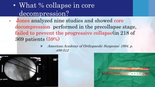Safe surgical dislocation[ssd] for avascular necrosis hip[ avn] | PPTX